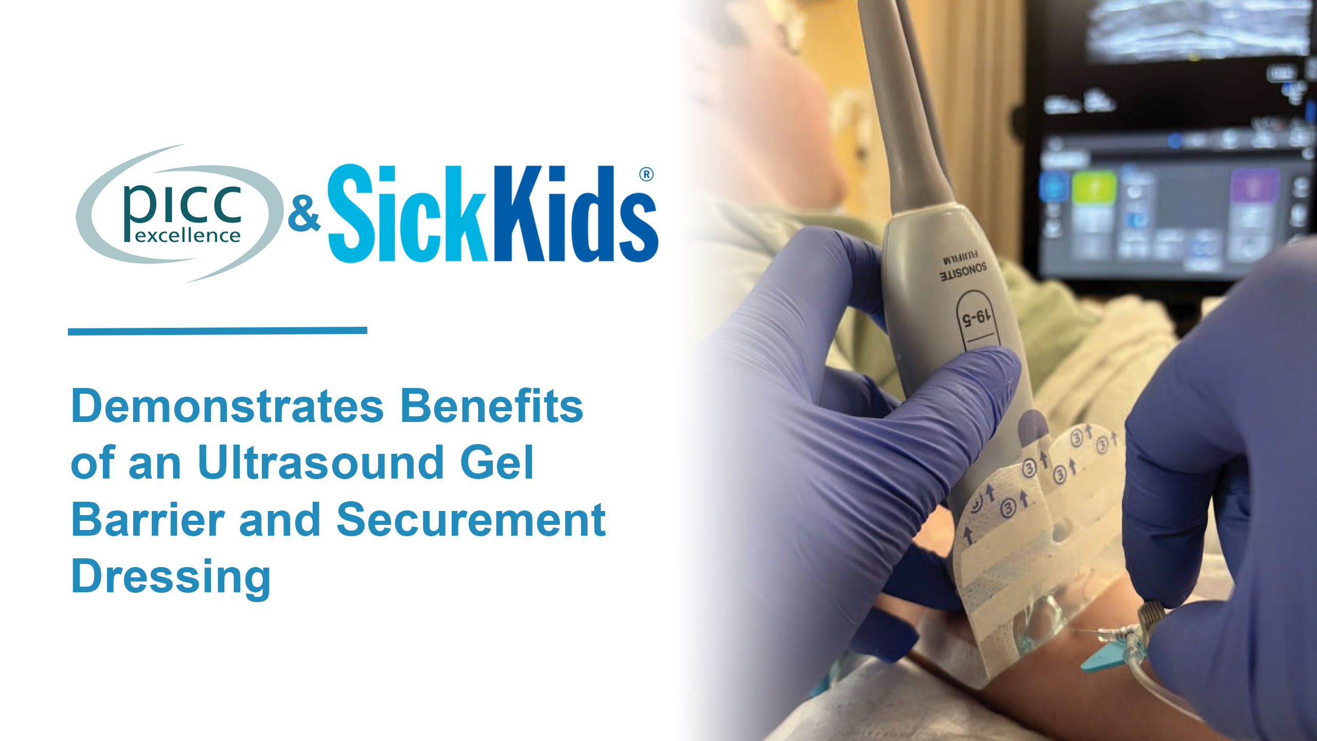 Feature image for PICC Excellence and SickKids Project Demonstrates Benefits of an Ultrasound Gel Barrier and Securement Dressing